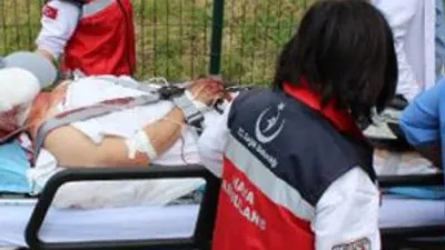 Yüzü tanınmayacak hale geldi !