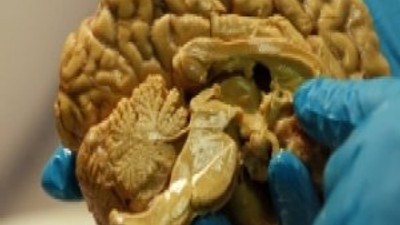 Einstein'in beynine büyük ilgi