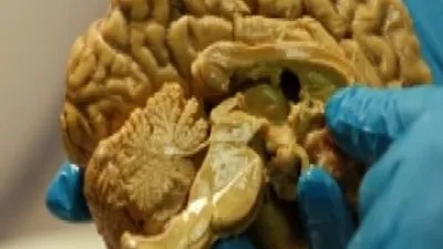 Einstein'in beynine büyük ilgi