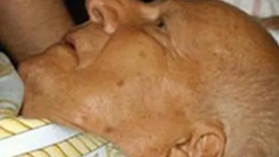 Kenan Evren'in gerçek ölüm nedeni ne ?