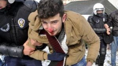 Üniversite karıştı: 28 gözaltı