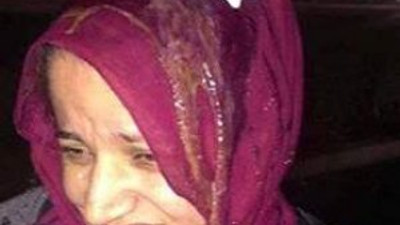 ABD'de başörtülü kadına yumurtalı saldırı