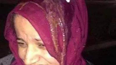 ABD'de başörtülü kadına yumurtalı saldırı