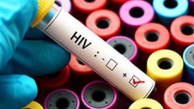 AYM'den AIDS kararı !