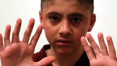 6 parmaklı olan çocuk bu durumu avantaja çevirdi