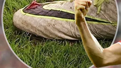 Lewandowski'nin kramponları paramparça