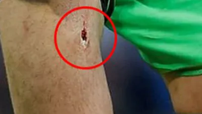 Victor Valdes'in maçta bacağı delindi