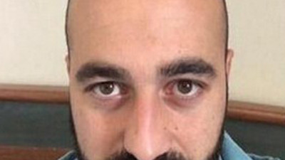 Saç ektirdi takımdan kovuldu