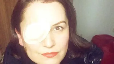 Genç kadın eğlenmeye gittiği barda kör oldu