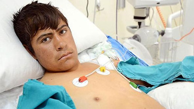 Kuşu kurtardı ama ellerinden oldu