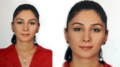 Estetik olmak istedi kalbi durdu !