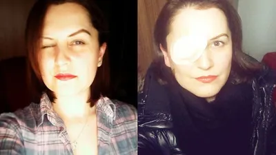 ''Evlenme imkanım kalmadı'' deyip dava açtı