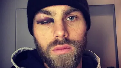 Elmander'in görüntüsü hayranlarını şok etti !
