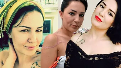 Genç yaşında hayatı karardı !