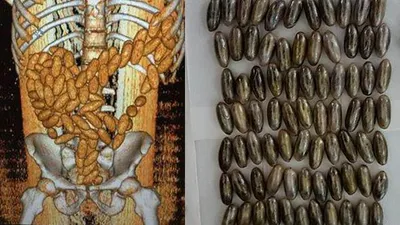 İçinden 102 tane çıktı ! Şüphelenince...