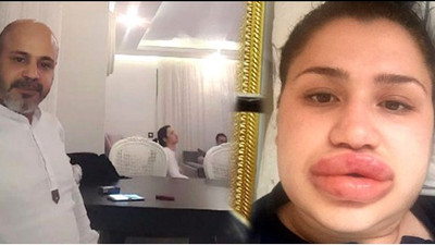 Silikon mağduru Merve hemşireye şok suçlama