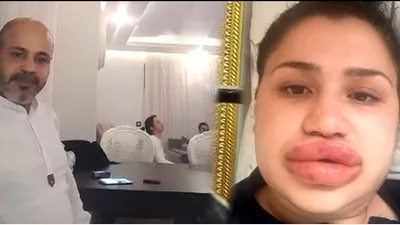 Silikon mağduru Merve hemşireye şok suçlama