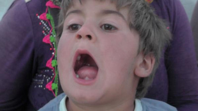 7 kardeşin de dişleri yok