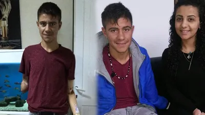 Güvercini kurtarmak için ellerini feda etmişti