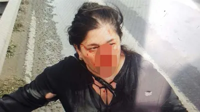 Uber şoföründen kadına dayak iddiası ! İfadesi ortaya çıktı