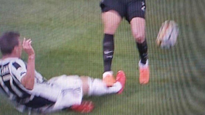 Mandzukic'in korkutan sakatlığı ! Bu hale geldi...