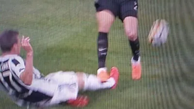 Mandzukic'in korkutan sakatlığı ! Bu hale geldi...