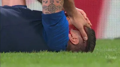 Giroud kanlar içinde yerde kaldı !