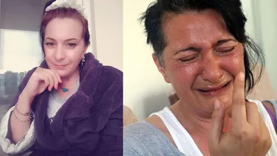 Beyaz diş hayali kabusa dönüştü !