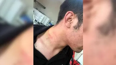AK Partili vekil CHP'li gencin boğazını sıktı