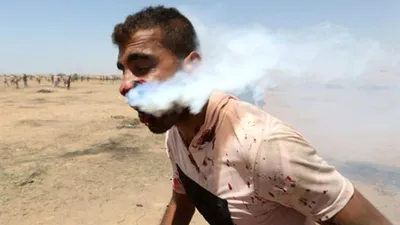 Ağzına gaz bombası atılan gençten haber var