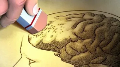 Diş eti iltihabı Alzheimer'a mı yol açıyor ?