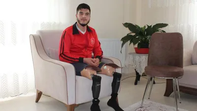 Gazilerimize protez bacak zulmü !