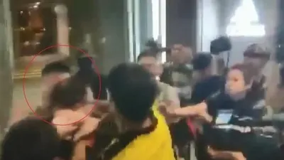 Dehşet anları kamerada ! Kulağını kopardı...