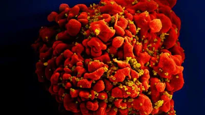 Yeni bir HIV türü keşfedildi!