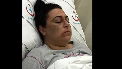 Yolda yürüyen 3 kadına saldırdı, ''Birine benzettim'' deyip serbest kaldı