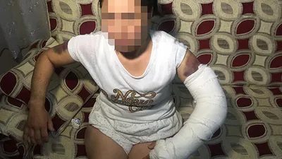 Karısını bu hale getirdi ! Korkunç olay...