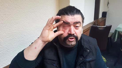 Asker eğlencesinde maganda dehşeti! Gözünden oldu!