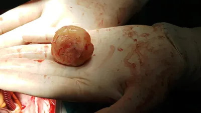 Kalbinden çıkarıldı doktorlar bile şoke oldu