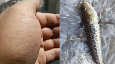Türkiye sahillerinde zehirli balık alarmı