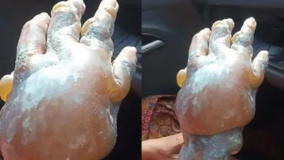 Yanan yere sakın bunları yapmayın !