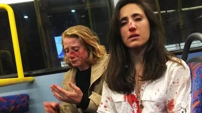 Öpüşmediler diye saldırıya uğradılar !