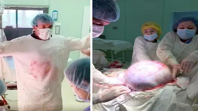 Kadının yumurtalıklarından çıkarıldı !