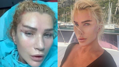 Seda Sayan'dan estetik sonrası ilk paylaşım