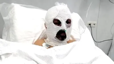 Şoförün üzerine tiner döküp yakan kadın tutuklandı !