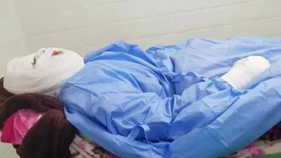 Uyuyan karısının üzerine kızgın yağ döktü