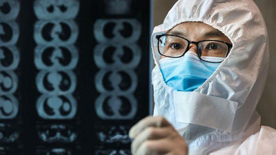 ''Koronavirüs hastalarında kalıcı organ hasarı meydana geliyor''