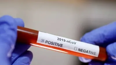 Koronavirüs aşısında testlere başlandı!