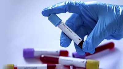 Cerrahpaşa Tıp Fakültesi Dekanı Gönen: Hasta sayıları stabilleşti