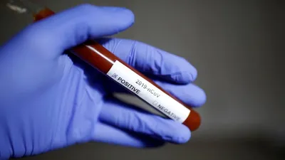 KKTC'den sevindiren haber! 1 aydır yeni vaka görülmedi