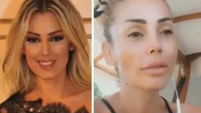 Petek Dinçöz son haliyle tanınmaz halde